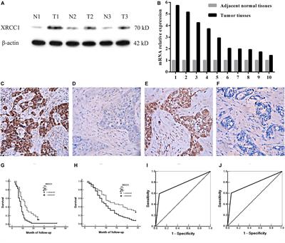 XRCC1 Is a Promising Predictive Biomarker and Facilitates Chemo-Resistance in Gallbladder Cancer